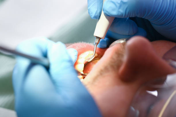 Best Urgent Care for Lost Fillings or Crowns in Winter Garden, FL